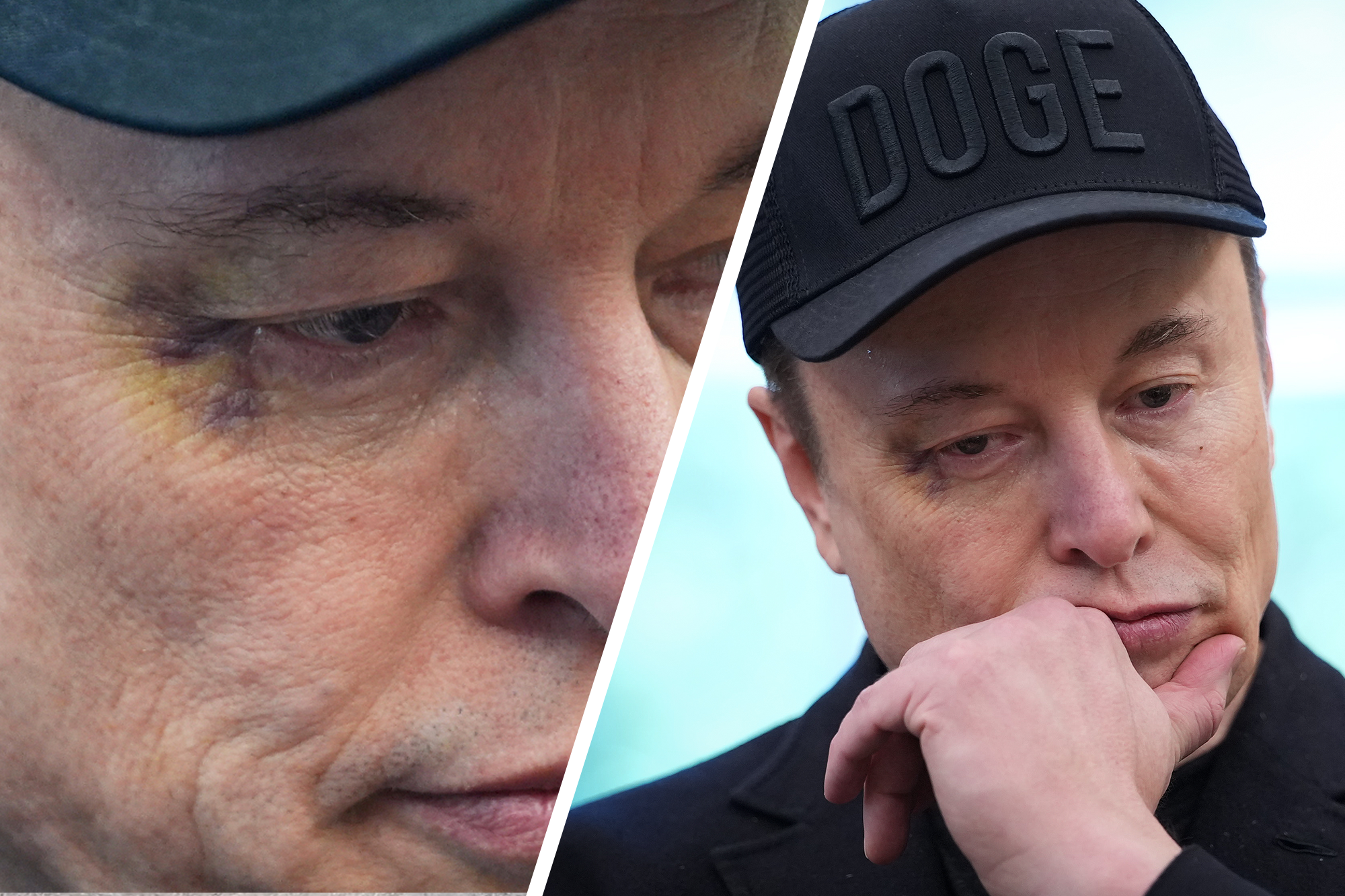 Elon Musk sports BLACK EYE, reveals who left him with shiner