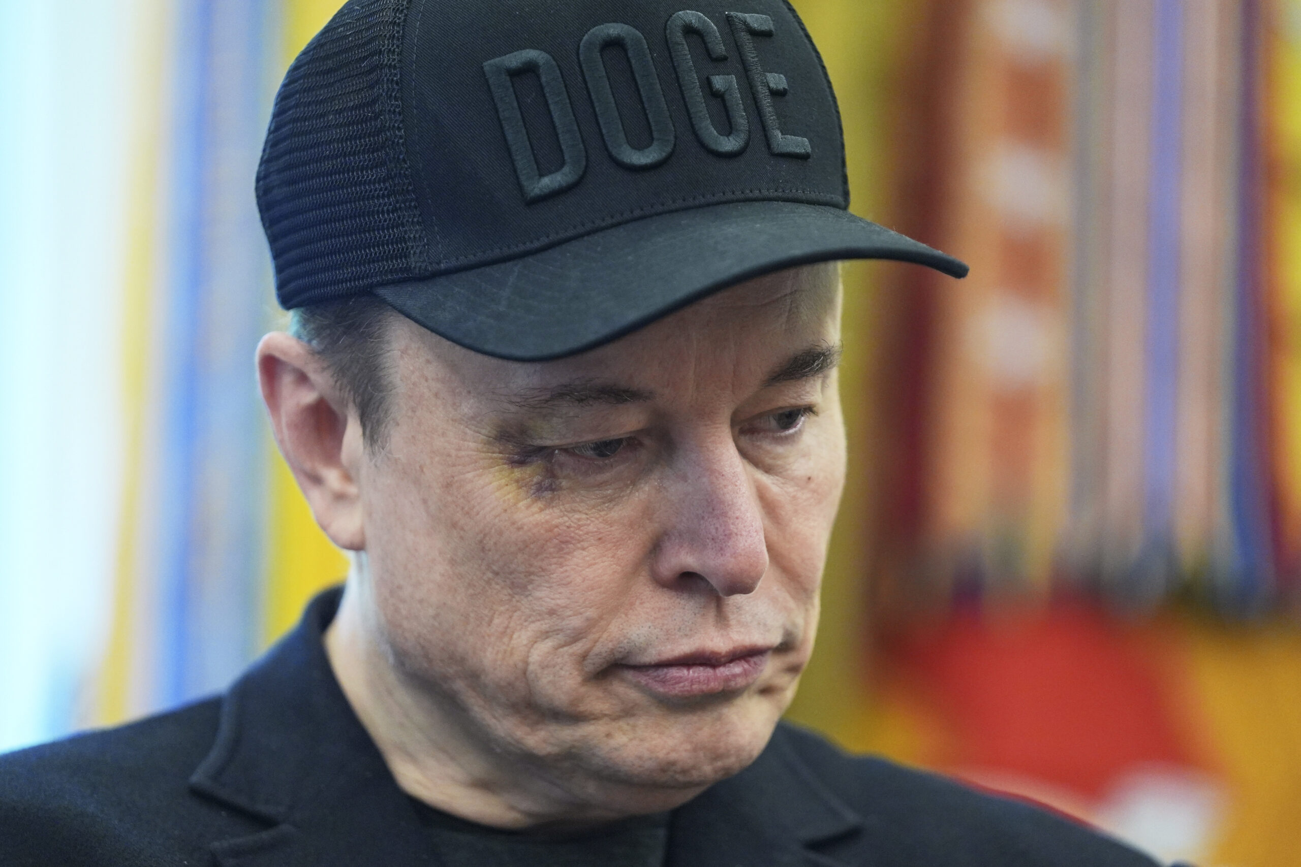 Elon Musk raises concerns after sporting black eye at White House farewell