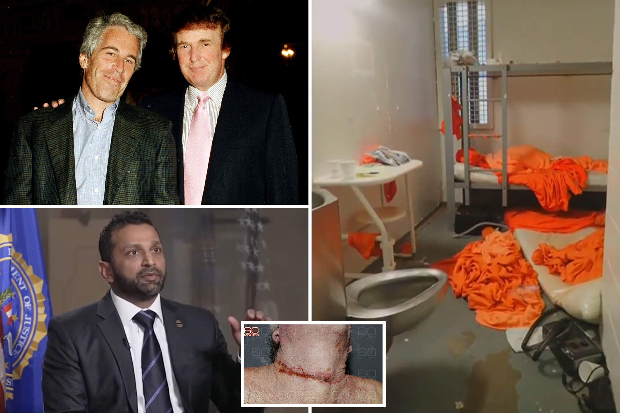Jeffrey Epstein’s brother slams FBI director for saying pedophile died by suicide: ‘No idea what the f—k he’s talking about’