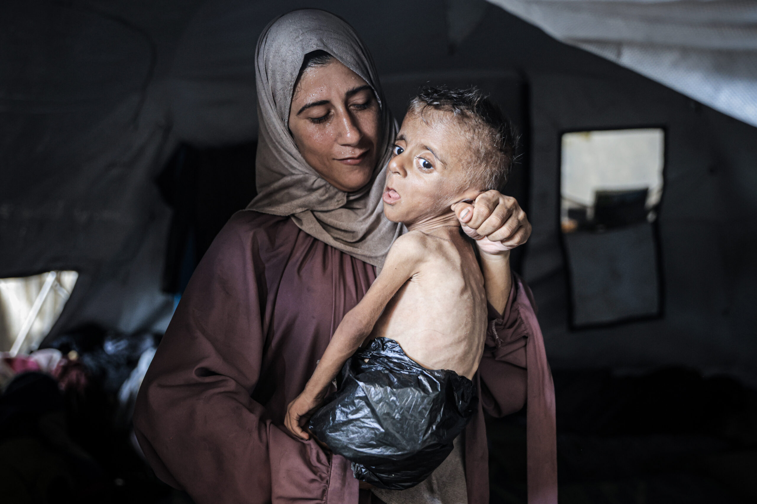 New York Times stunningly rolls back claims about viral photo of starving Gaza boy