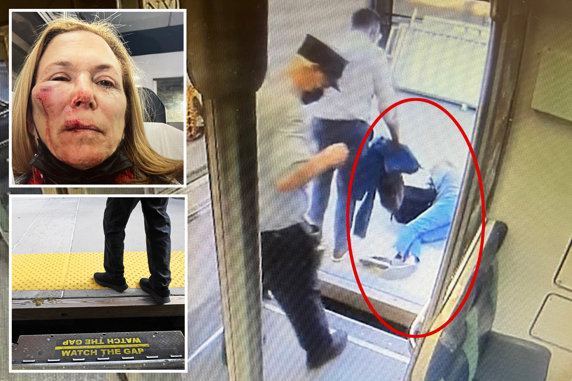 MTA’s faked safety checks at station led to gruesome injuries, platform mishap: Lawyer