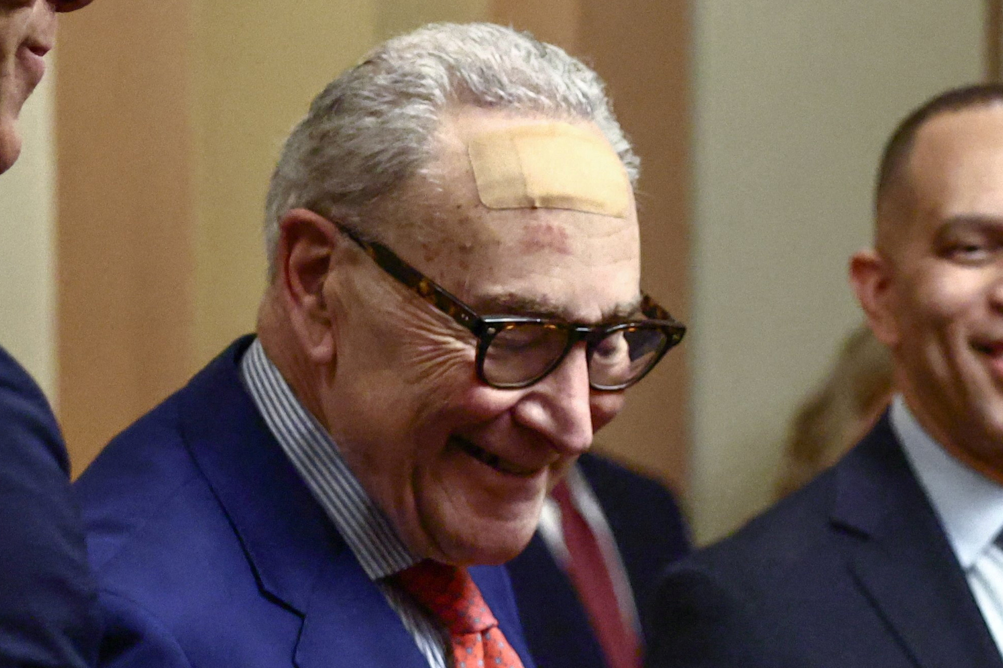 Chuck Schumer wore a giant bandage on his forehead for King Charles III’s speech — then offers off-the-wall explanation for why
