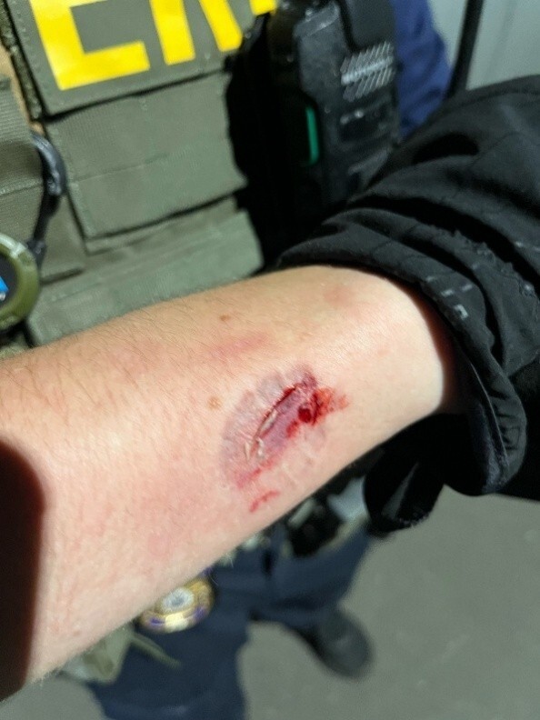 Anti-ICE agitator charged with allegedly biting officers during Delaney Hall protest